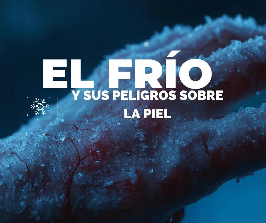 Las consecuencias del frio en la piel