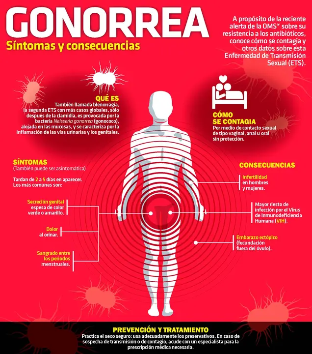 Gonorrea