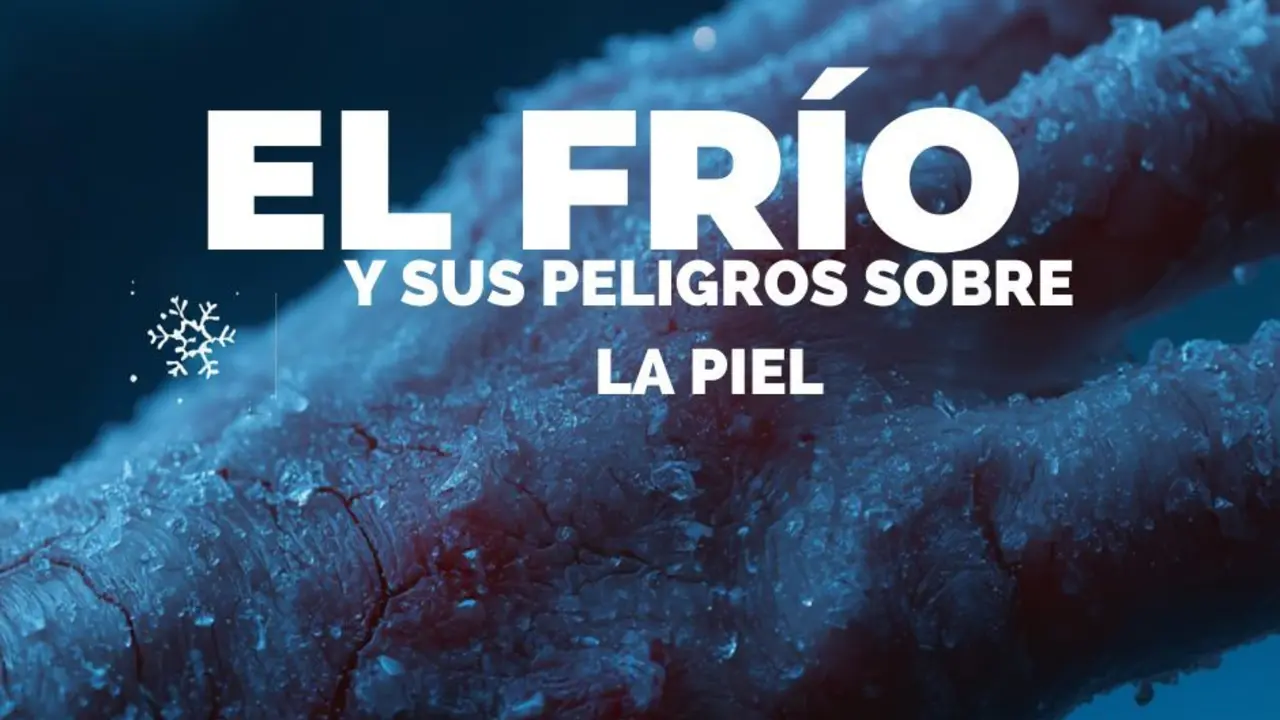 Las consecuencias del frio en la piel