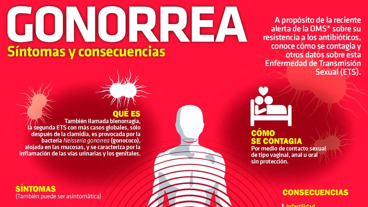 Gonorrea