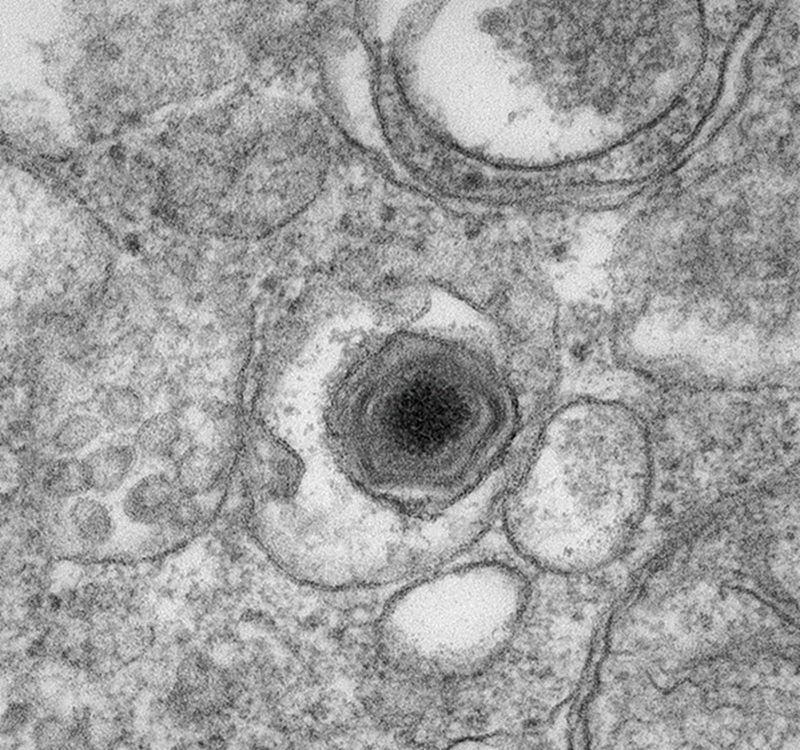 Virus de la peste porcina africana. Ben Clark (Wikimedia Commons)